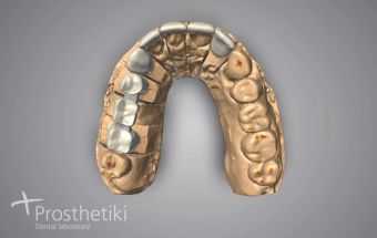 Τεχνολογία CAD/CAM (3)
