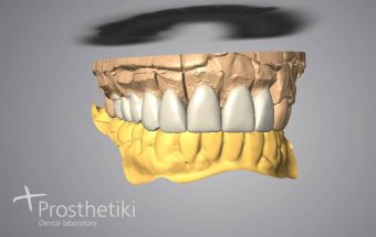 Τεχνολογία CAD/CAM (4)